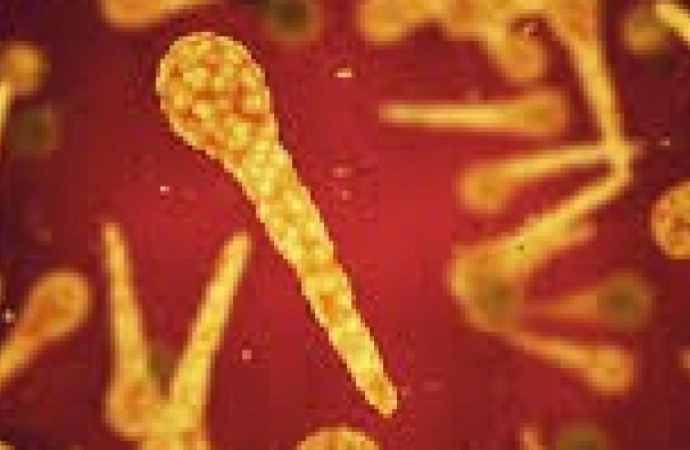 Warmińsko-mazurski Sanepid informuje o wykryciu przypadków zachorowań na świńską grypę oraz na odrę.